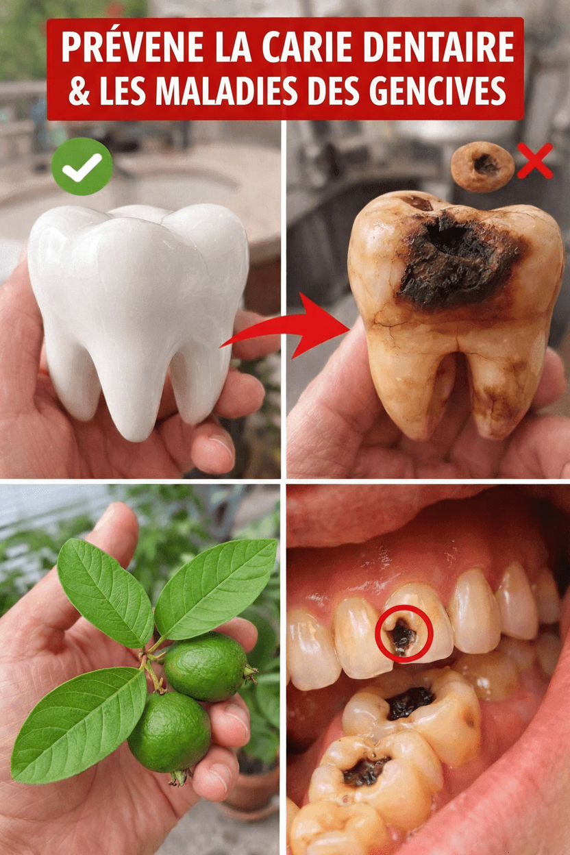 Le Dentiste Naturel : Un Guide Pratique pour des Soins Bucco-Dentaires Quotidiens avec les Feuilles de Goyave