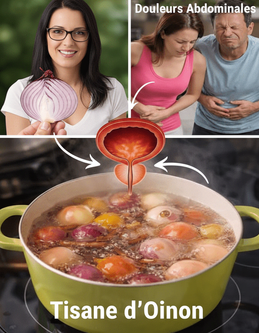L'oignon bouilli : un remède naturel potentiel pour apaiser l'inflammation de la vessie, soulager la douleur urinaire et soutenir la santé rénale