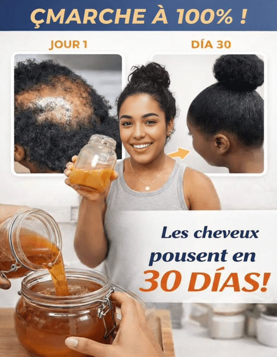 Envie d'Accélérer la Croissance de Vos Cheveux et de Redensifier les Zones Clairsemées ? Découvrez Ce Puissant Remède Maison avec Recette Complète