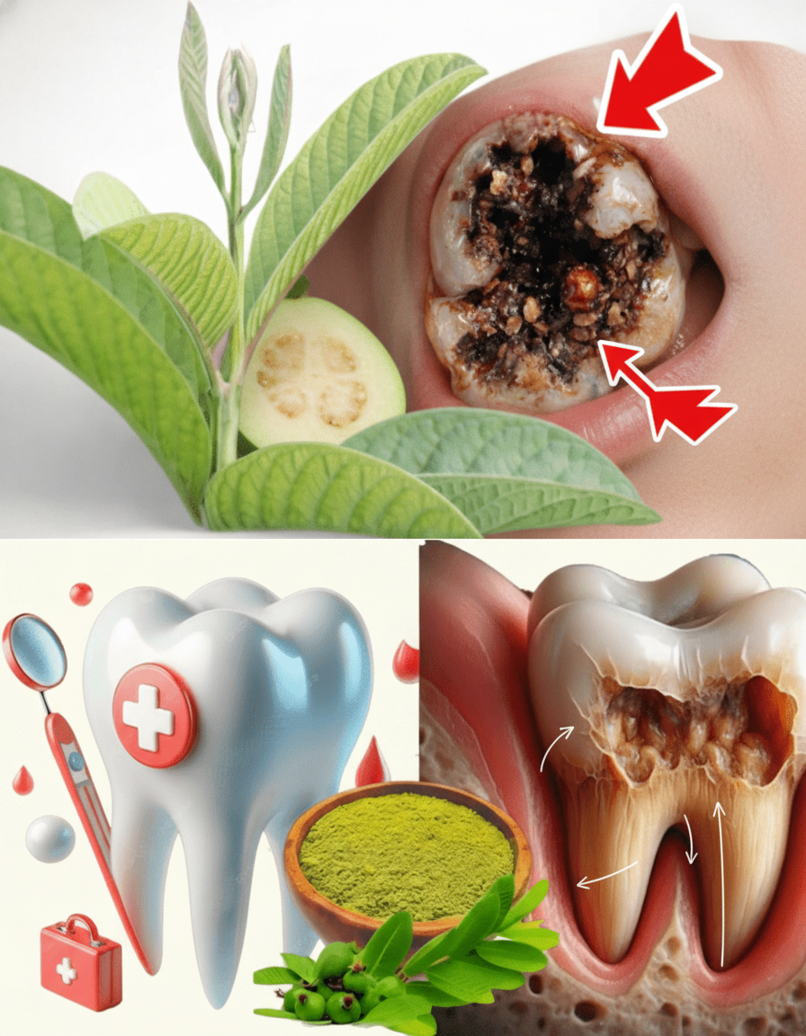 Feuilles de Goyave : 3 Méthodes Simples et Économiques pour Combattre la Carie Dentaire