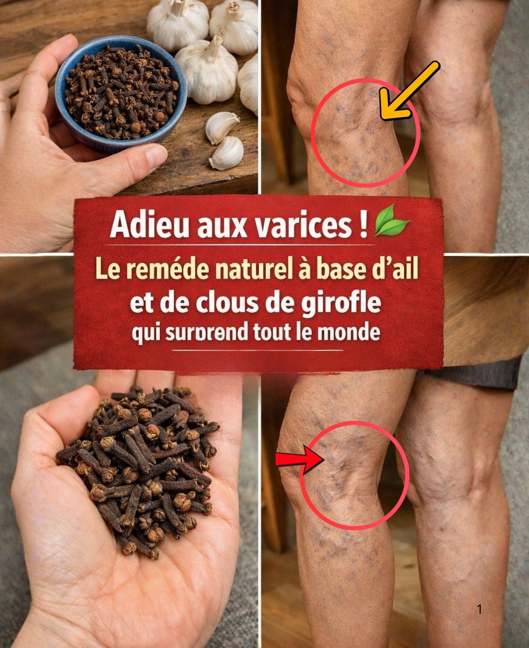 L'ail, les clous de girofle et le gingembre : un puissant remède naturel pour combattre les varices et optimiser la circulation sanguine