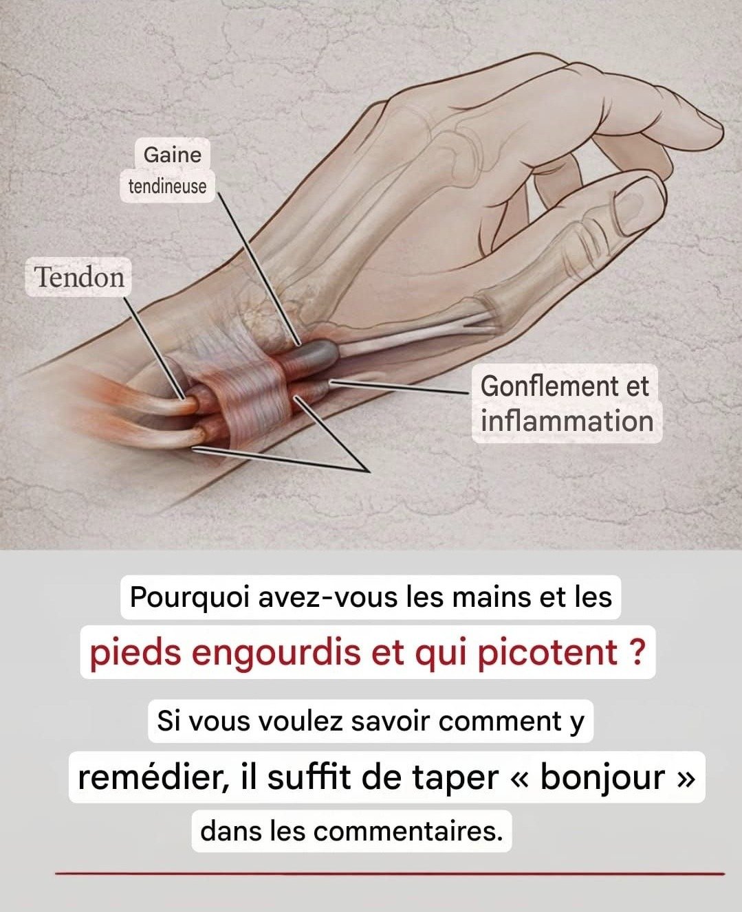 Mains engourdies : Comprendre les causes et découvrir des solutions naturelles efficaces.