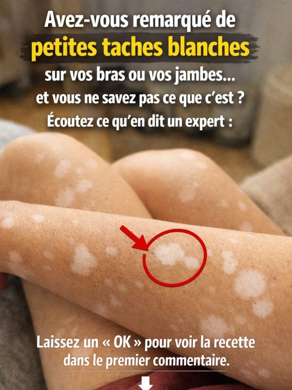 Le VRAI secret des taches blanches sur vos ongles révélé (Ce n'est PAS ce que vous croyez !)