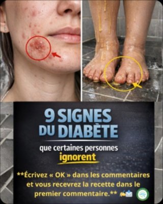 Le Diabète vous Guette ? 9 Signes Cruciaux que Vous Ignorez Peut-Être (Le Dernier Est ÉPOUSTOUFLANT !)