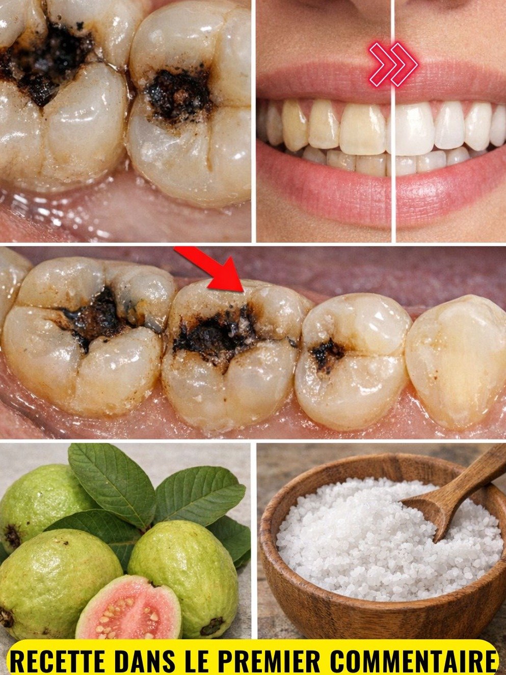 Le Secret OUBLIÉ pour des Dents Saines : 3 Remèdes Révolutionnaires aux Feuilles de Goyave Contre les Caries que Personne ne Vous Dit !