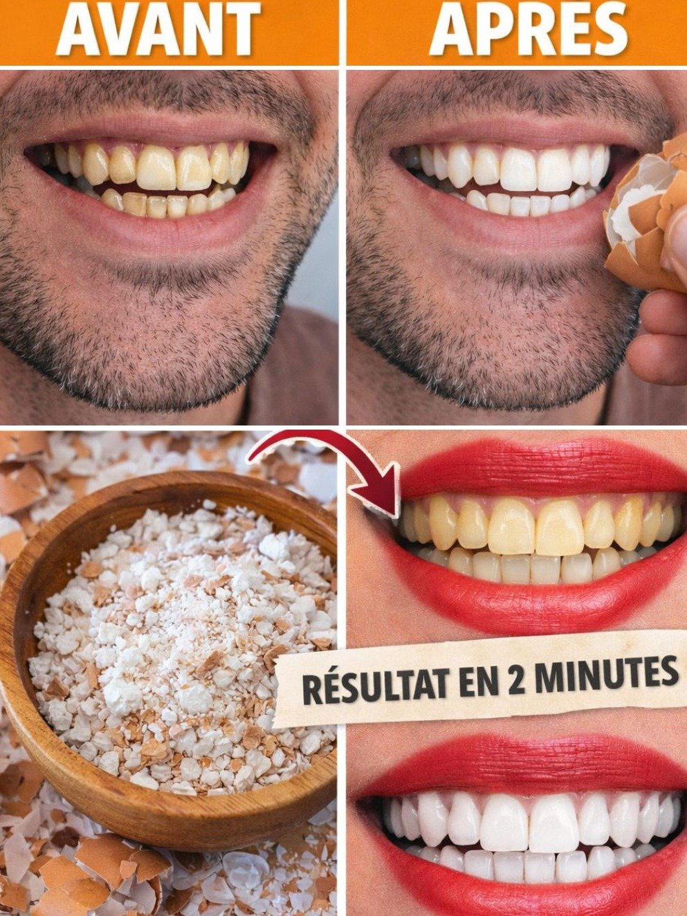 Le Secret Viral pour des Dents BLANCHES en 5 Minutes Chrono : Dites Adieu au Jaune Naturellement !