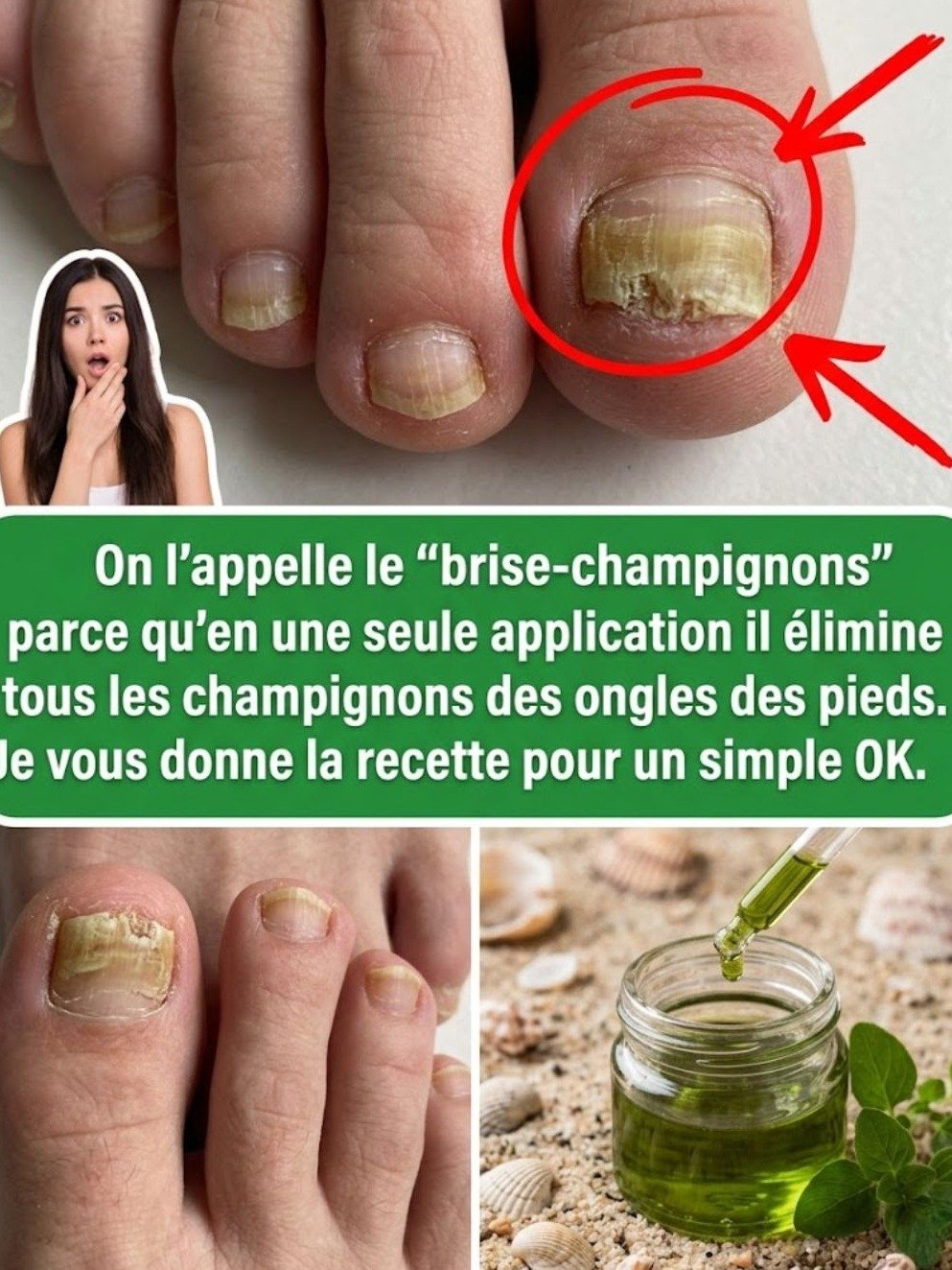 Le Secret ANTI-MYCOSE Que Personne Ne Vous Dit : L'Origan Va Sauver Vos Ongles (Avant Qu'il Ne Soit Trop Tard) !