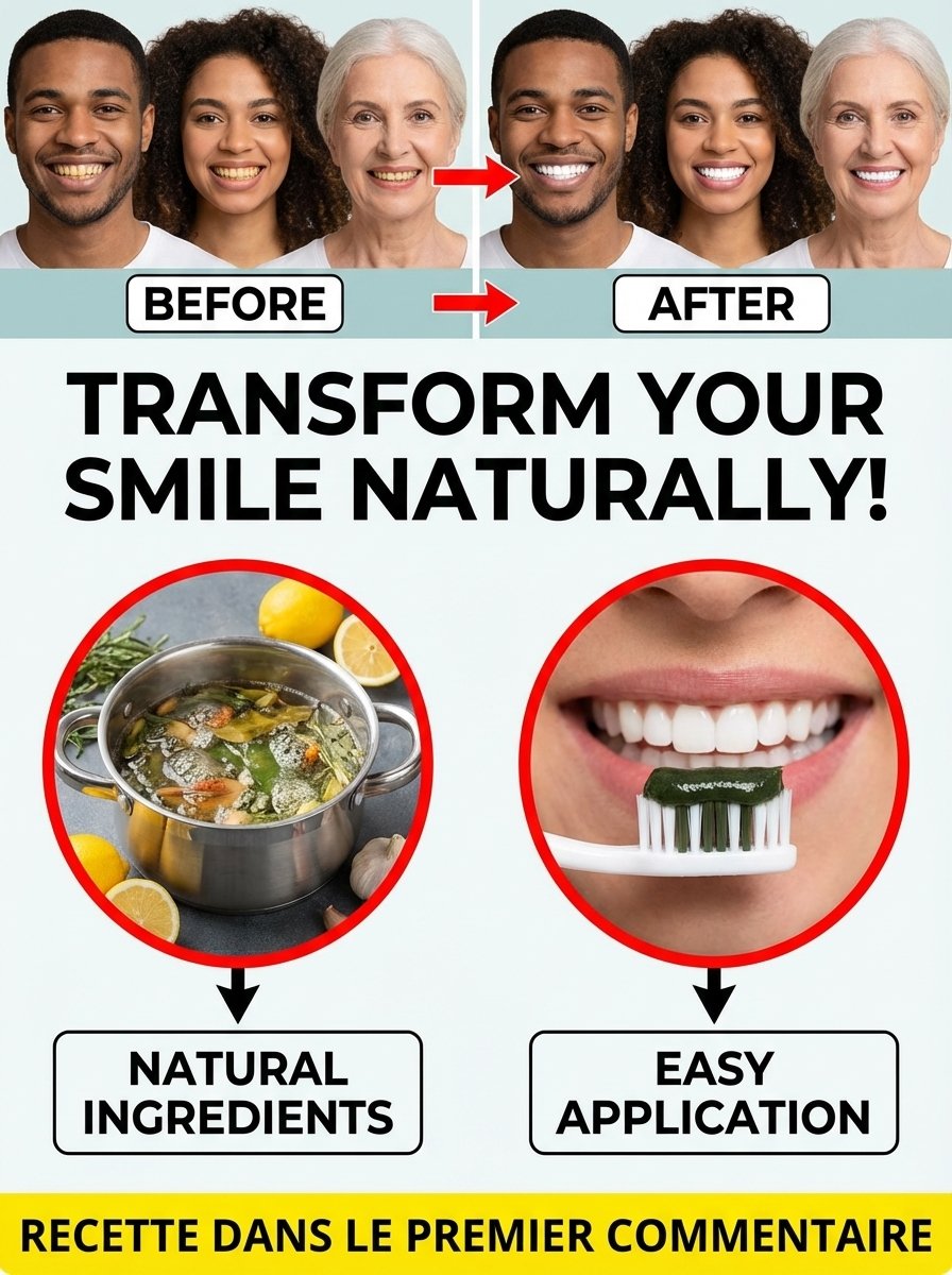 L'erreur FATALE que tout le monde fait pour blanchir ses dents (L'AIL est votre pire ennemi) – 7 méthodes PROUVÉES pour un sourire ÉCLATANT en 14 jours SANS DANGER !