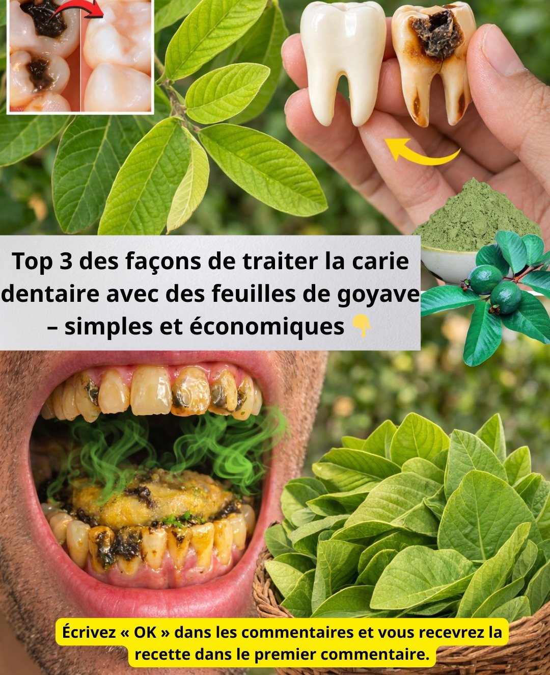 Feuilles de Goyave contre les Caries : 3 Solutions Simples et Économiques pour votre Santé Buccale