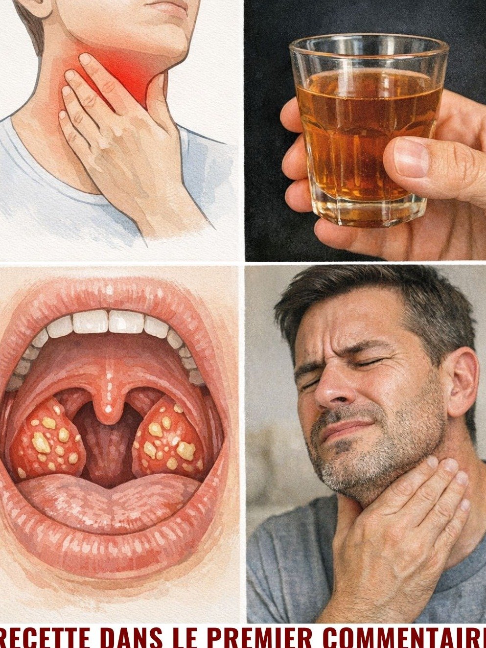 Mal de Gorge : 10 Remèdes Secrets de Grand-Mère pour un Soulagement IMMÉDIAT (Vous avez déjà TOUT dans votre cuisine !)