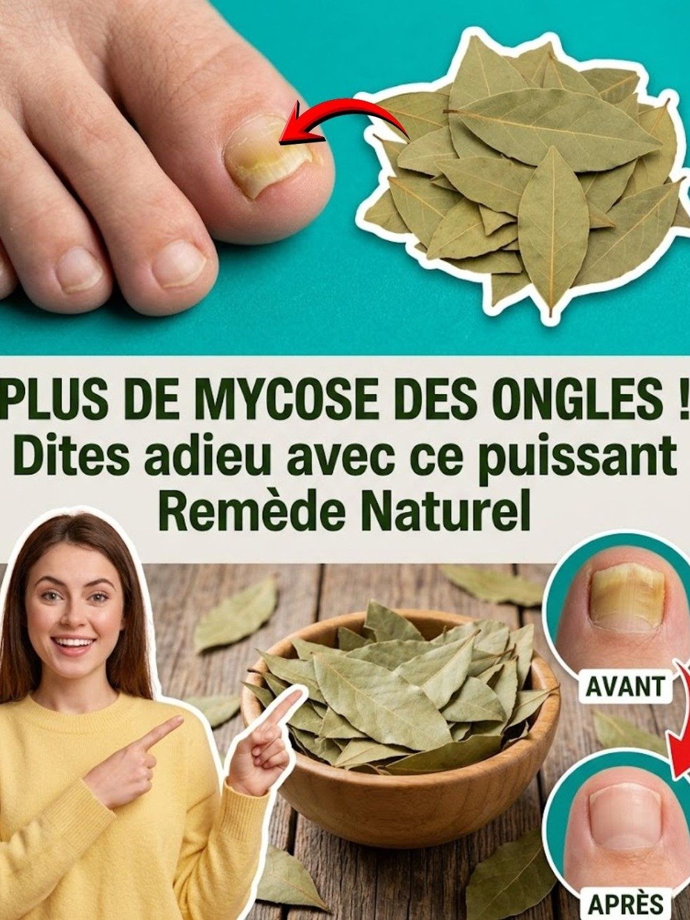 Le Secret Naturel Ultime pour Éradiquer la Mycose des Ongles : Le Laurier, Votre Allié Insoupçonné !