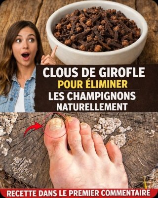 Le Secret OUBLIÉ pour Éradiquer la Mycose des Ongles : 3 Recettes aux Clous de Girofle qui Vont Vous BLUFFER !