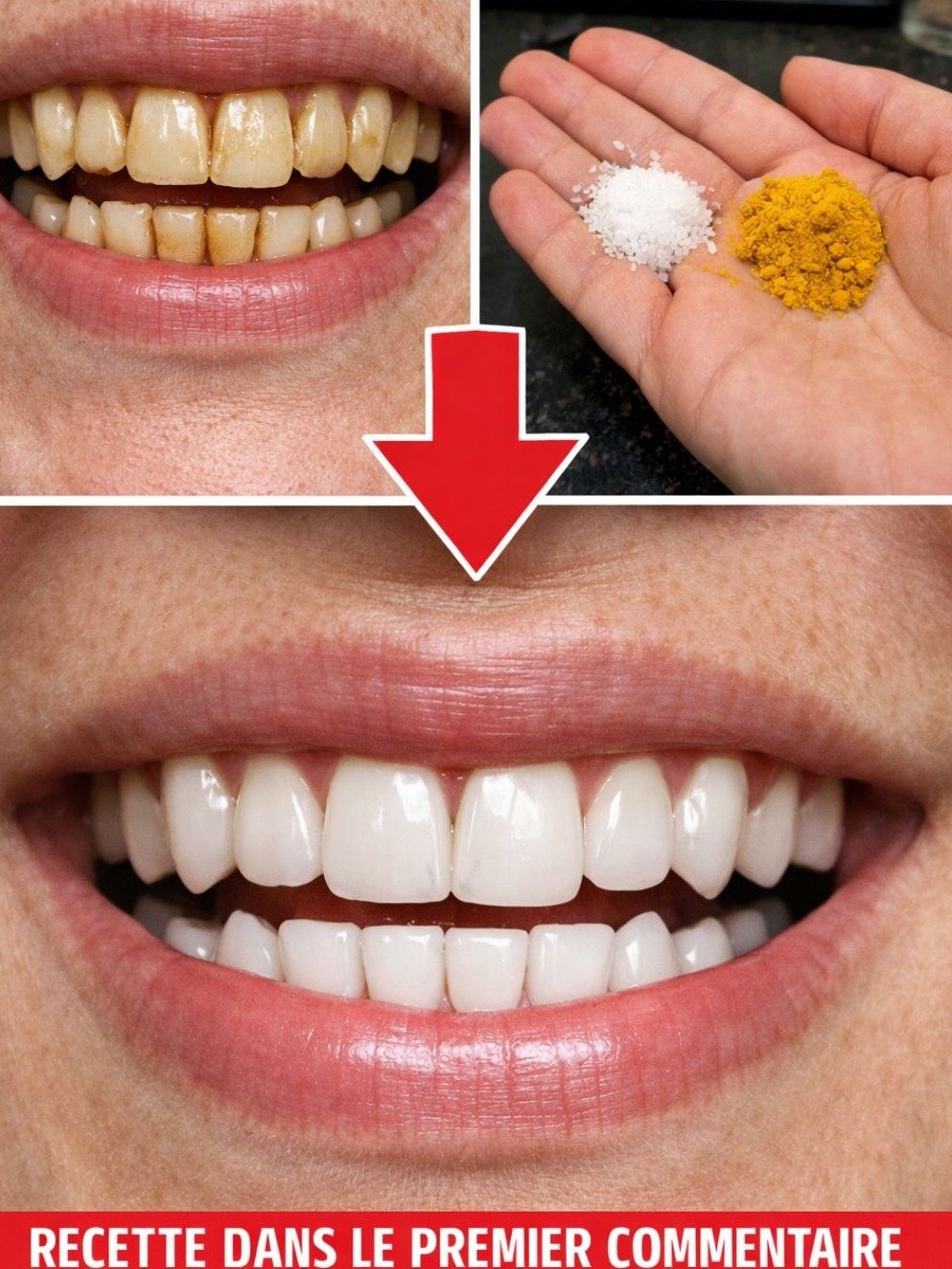 Le Secret Millénaire Révélé : Ce Duo Curcuma-Bicarbonate Va Révolutionner Votre Sourire en Seulement 7 Jours ! (Votre Dentiste Ne Vous Le Dira Jamais)