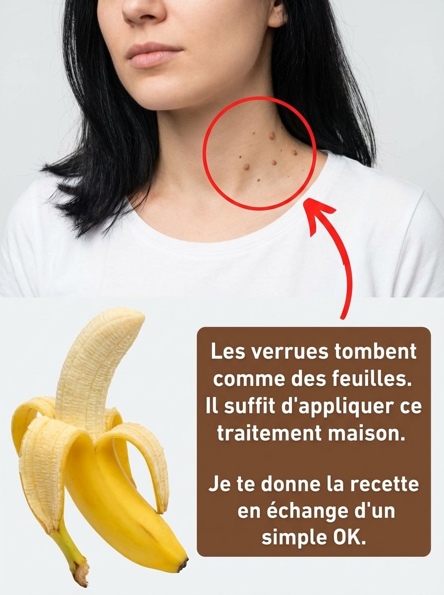 Verrues : Le Secret ULTIME de la Peau de Banane pour les Éradiquer Naturellement (3 Recettes Incroyables à Essayer Absolument) !