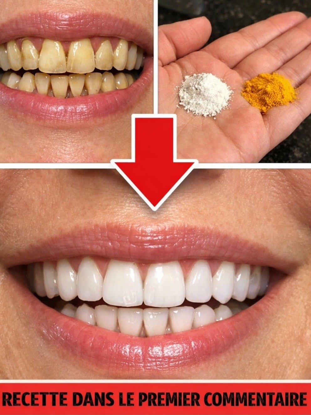 Découvrez le Secret Ultime pour des Dents BLANCHES et Saines en 7 Jours (Les Dentistes N'en Croiront Pas Leurs Yeux) !