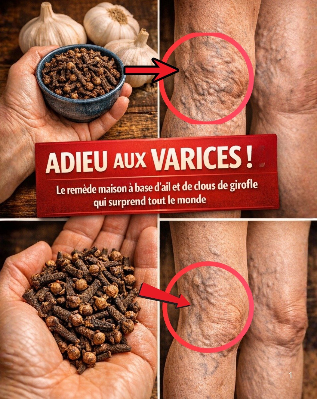 Révélation Choc : Ce Trio Naturel (Ail, Clous de Girofle, Gingembre) Va Éradiquer Vos Varices et Réinventer Votre Circulation !