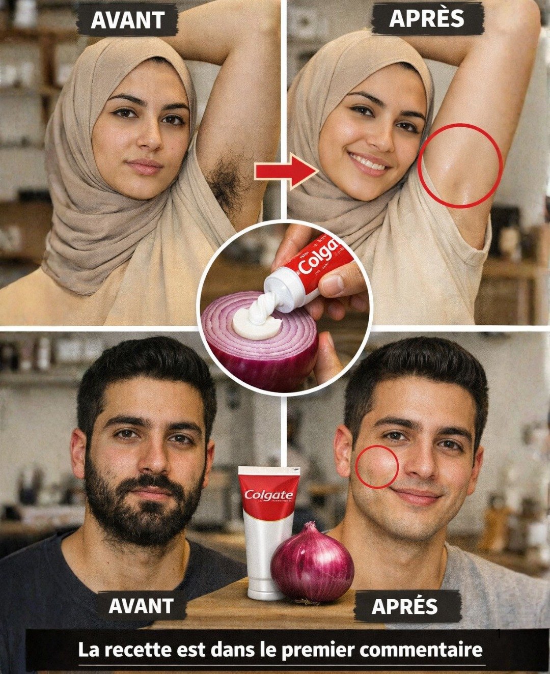 Révélez une peau soyeuse : l'épilation naturelle express en deux minutes chrono !