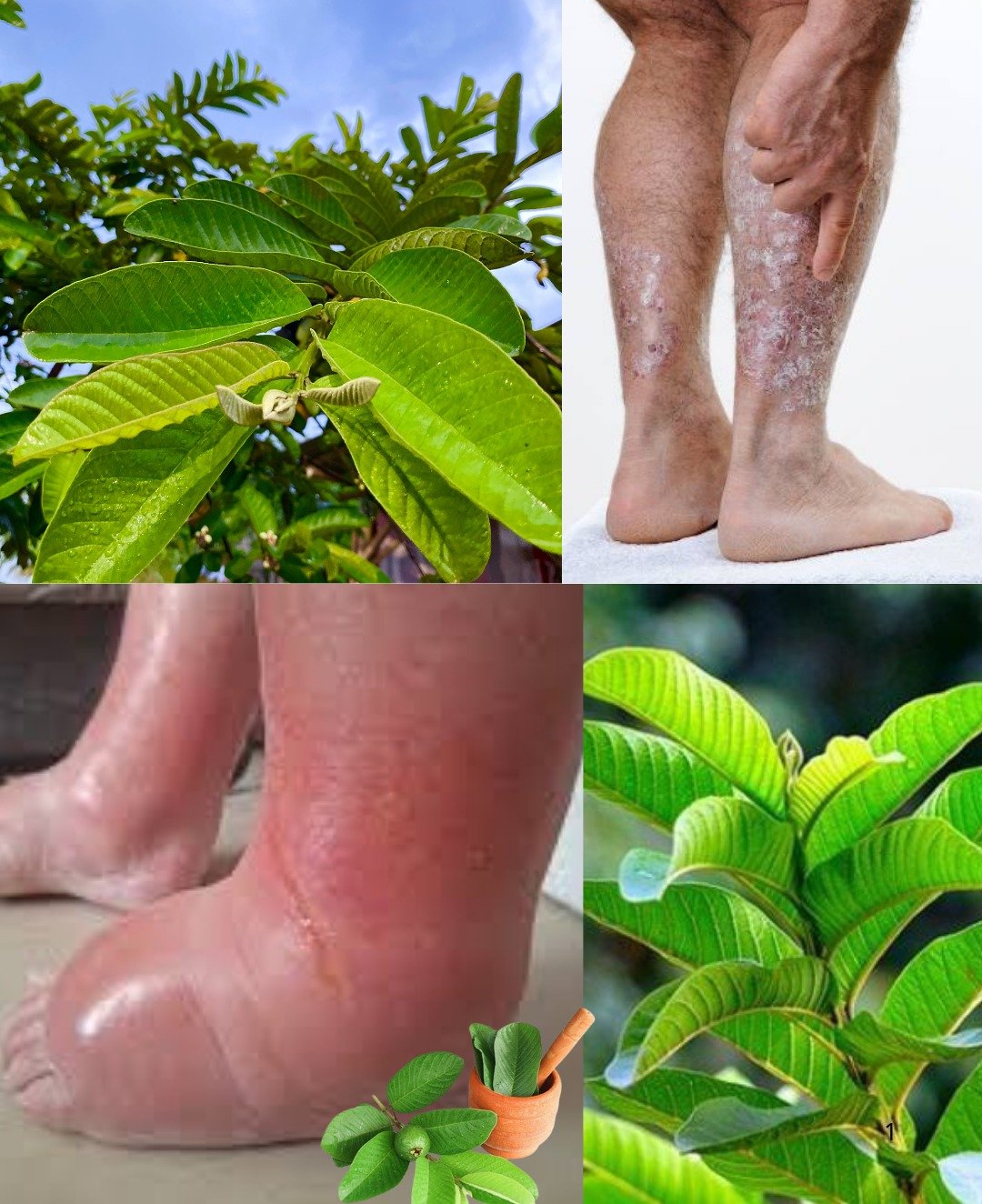 Le secret naturel insoupçonné : ces feuilles vertes font disparaître les chevilles gonflées en une nuit