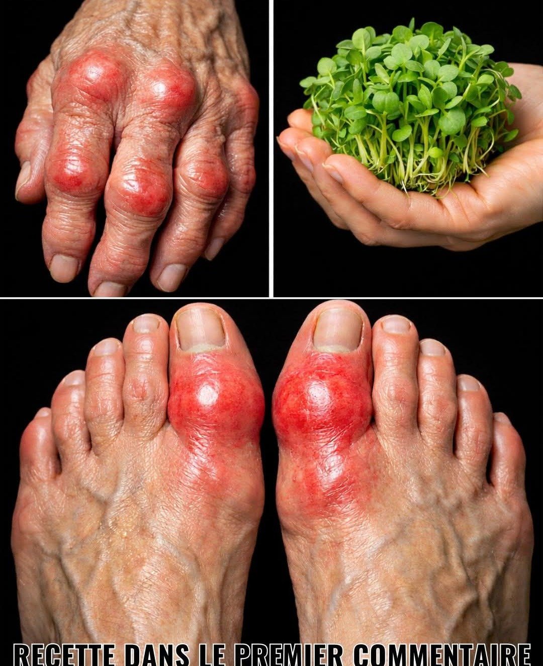 La luzerne : une alliée verte et douce pour le soutien rénal et articulaire