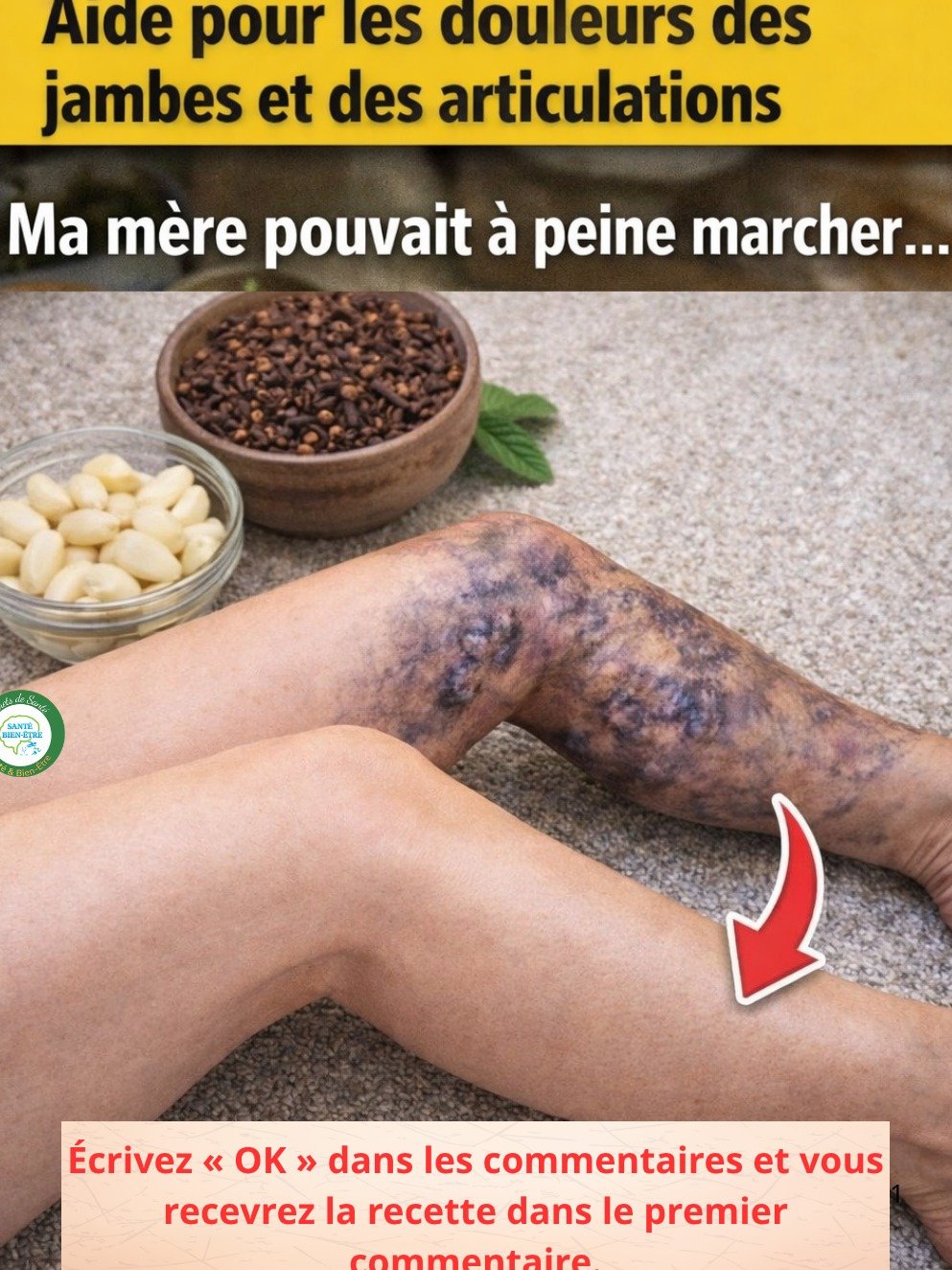 Jambes Lourdes et Douloureuses ? Le Secret Insoupçonné de Ma Mère Trouvé Dans SA Cuisine Va VOUS Épater !