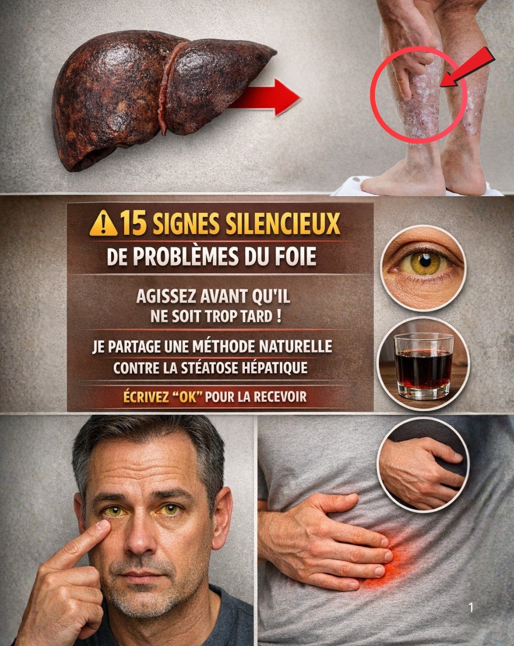 Attention ! Ces 7 Signes SILENCIEUX de Foie Gras que Vous NE DEVEZ JAMAIS Ignorer (Votre Santé en Dépend !)