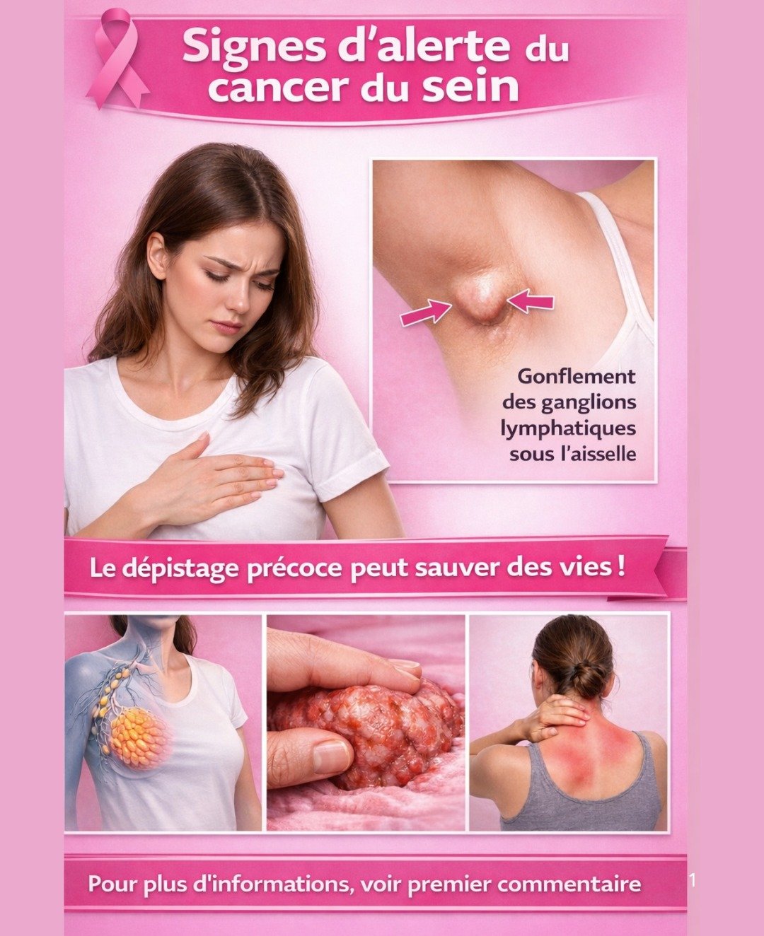 10 Signes Cruciaux du Cancer du Sein à Ne Jamais Ignorer