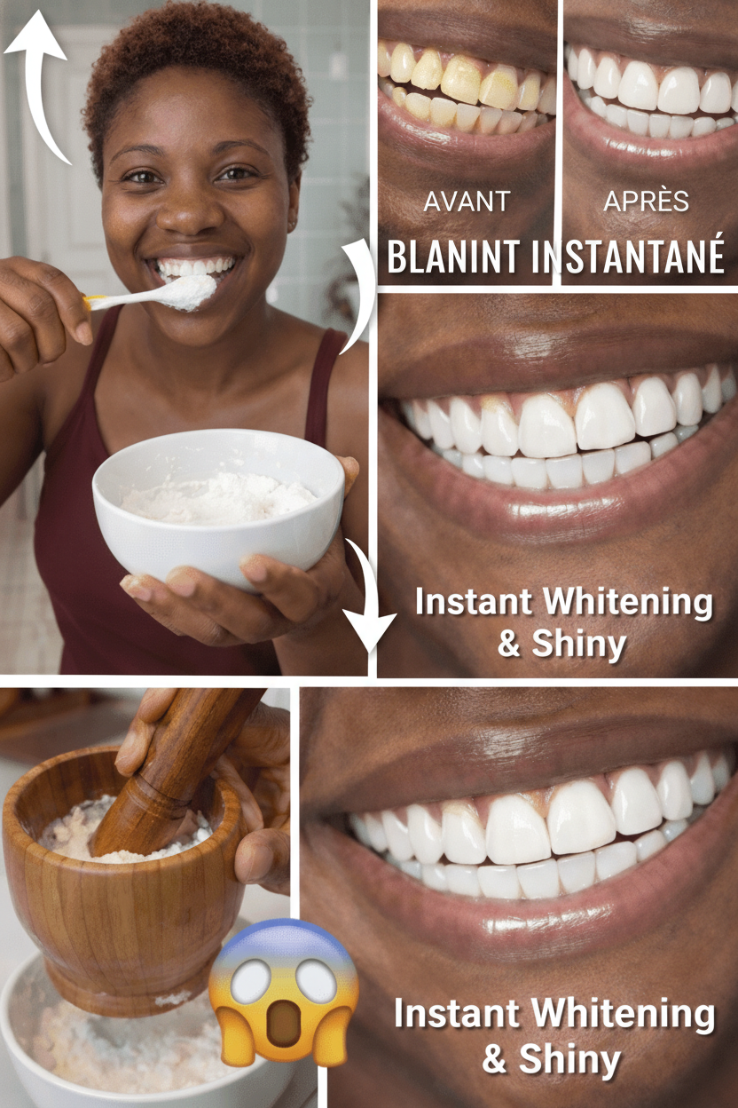 Banane, Gingembre et Citron pour des Dents Plus Blanches ? Décrypter les Remèdes Naturels et Protéger Votre Émail