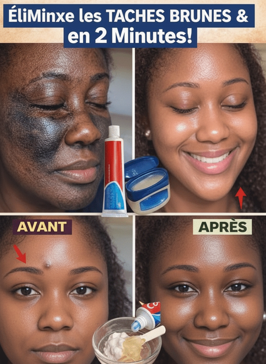 Dentifrice et Vaseline sur le Visage : Décryptage d'une Tendance Beauté Surprenante