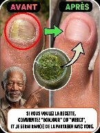 Le Secret Caché : Éliminez les Mycoses de Vos Pieds et Ongles Définitivement avec CE Remède Maison Simple !