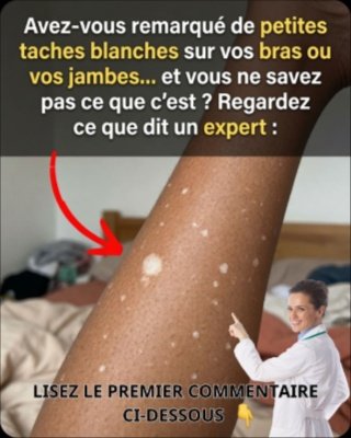 Attention : Ces Taches Blanches sur Votre Peau Cachent Peut-être un Secret ! Les 5 Causes à Connaître Absolument