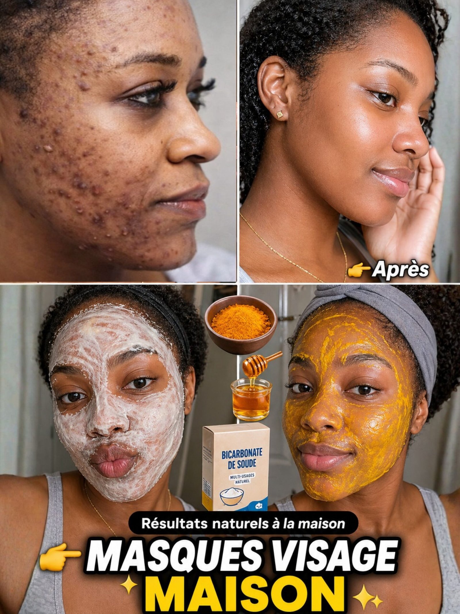 Le Secret OUBLIÉ de Votre Placard qui Va Éradiquer Votre Acné et Illuminer Votre Peau en Quelques Semaines (Le N°3 Va Vous Bluffer) !