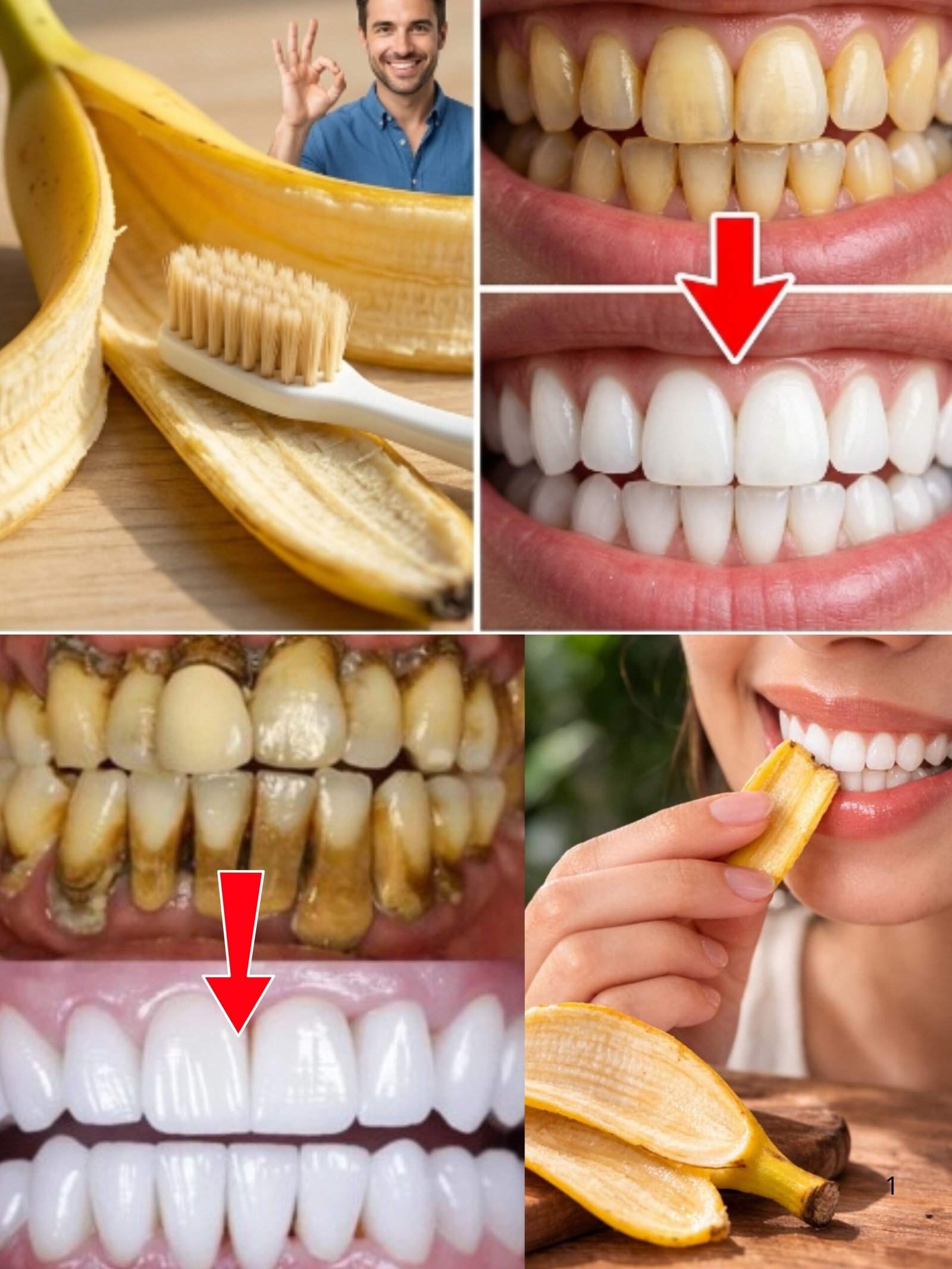STOP ! Ne Jetez PLUS vos Peaux de Banane : Le SECRET ÉPOUSTOUFLANT pour des Dents BLANCHES en 2 Minutes (Que Votre Dentiste Cache) ! 🪥🦷