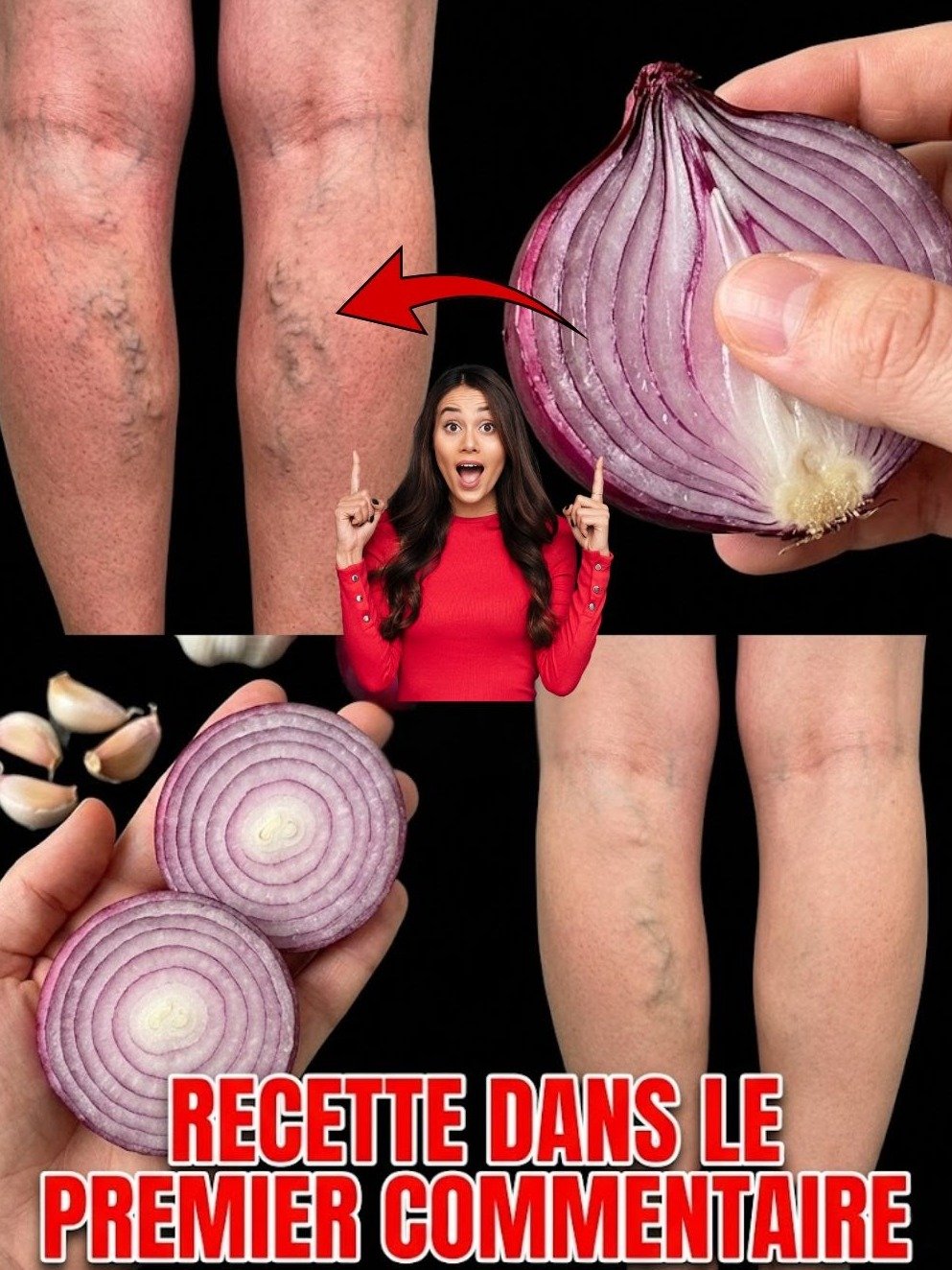 Le Secret Étonnant de l'Ail : 3 Ingrédients Simples Pour Dire Adieu aux Varices et Retrouver des Jambes Légères !