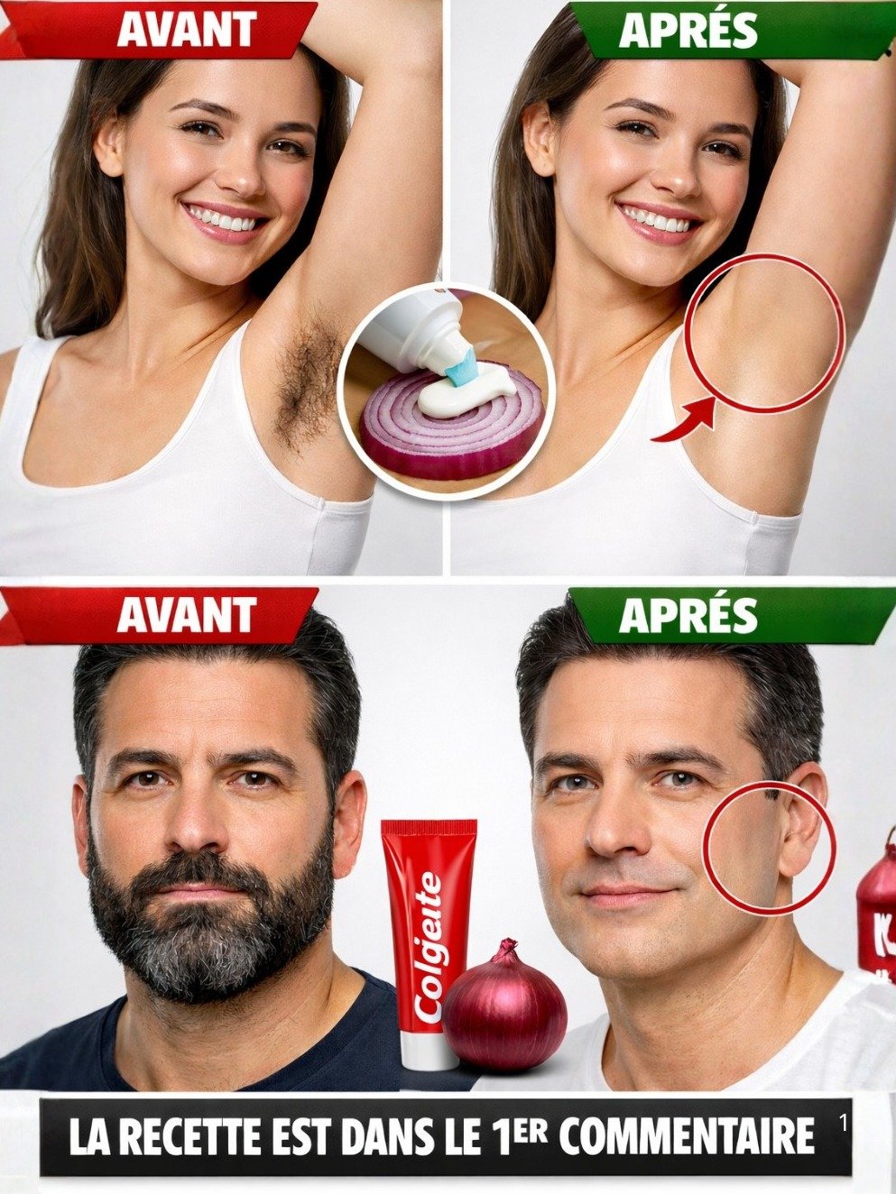 Le Secret Révélé : Obtenez une Peau Parfaitement Lisse en 2 Minutes, SANS Douleur ni Irritation ! (Vous Allez Adorer)