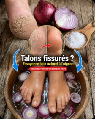 Adieu les talons secs et douloureux ! Découvrez les 5 remèdes maison ÉTONNANTS qui vont transformer vos pieds (le #1 est un secret bien gardé !) 👣✨
