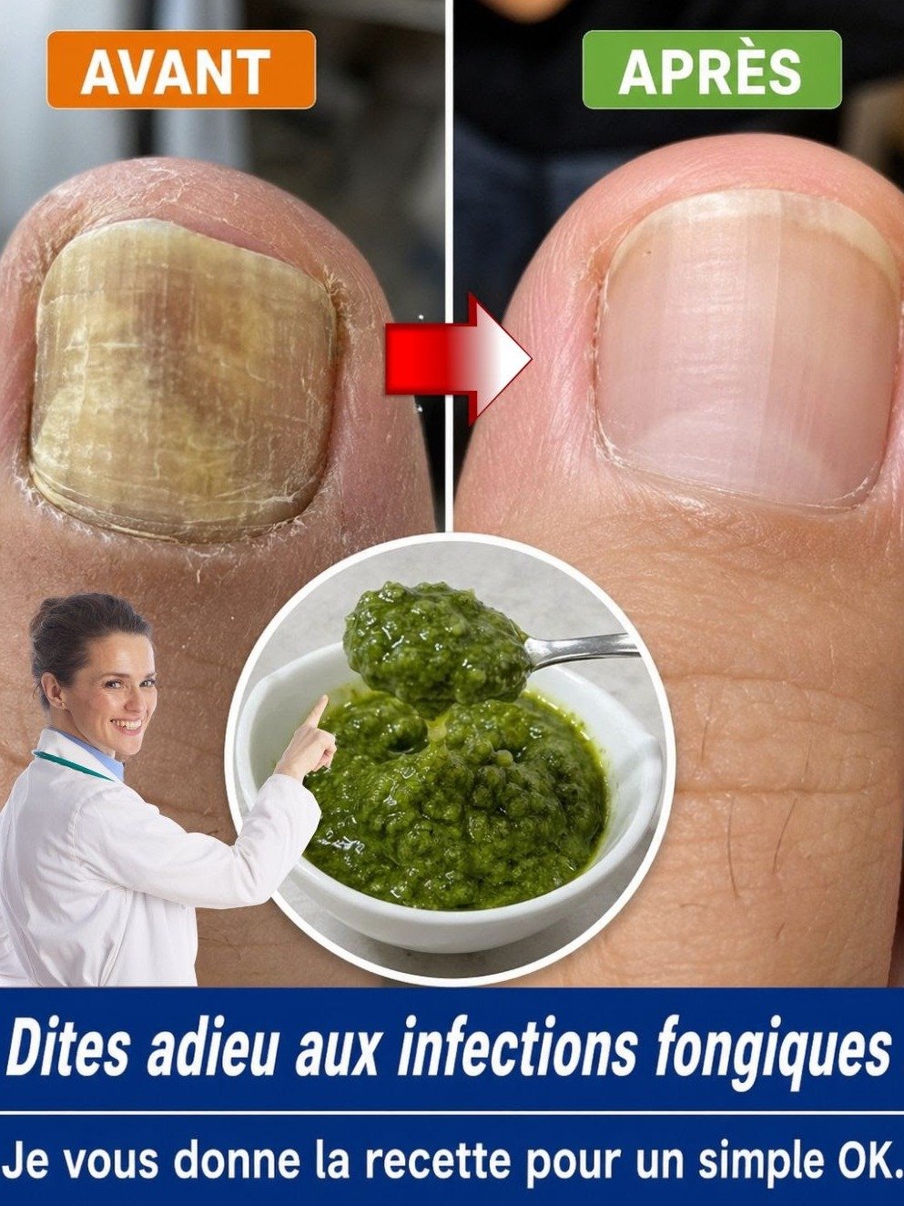 Le Secret ANTI-MYCOSE de Grand-Mère Révélé : Dites ADIEU aux Ongles Jaunes et Pieds Qui Démangent avec ce Duo Ail-Vinaigre !