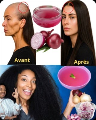 Le Secret Viral des Cheveux Longs et Épais : 3 Remèdes Simples à l'Oignon Rouge que TOUT LE MONDE Devrait Connaître !