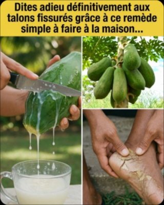 Le Secret Insoupçonné pour des Talons de Rêve : Ce Liquide Naturel de Papaye Va Tout Changer !