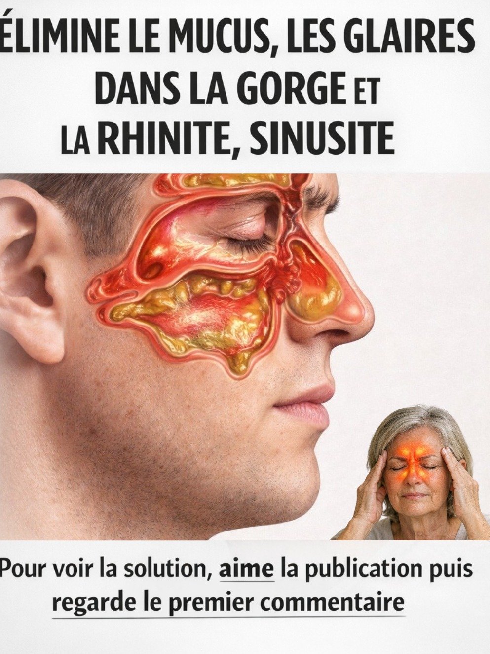 STOP au Mucus & Rhinite ! Découvrez les 7 Remèdes Maison Infaillibles pour Respirer Enfin Librement (Le N°4 Va Vous Étonner)