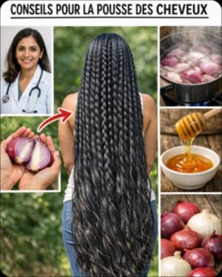 Cheveux Fins, Chute ? Ce Que Fait 1 Oignon Cru sur Votre Cuir Chevelu la Nuit Va Vous Étonner !