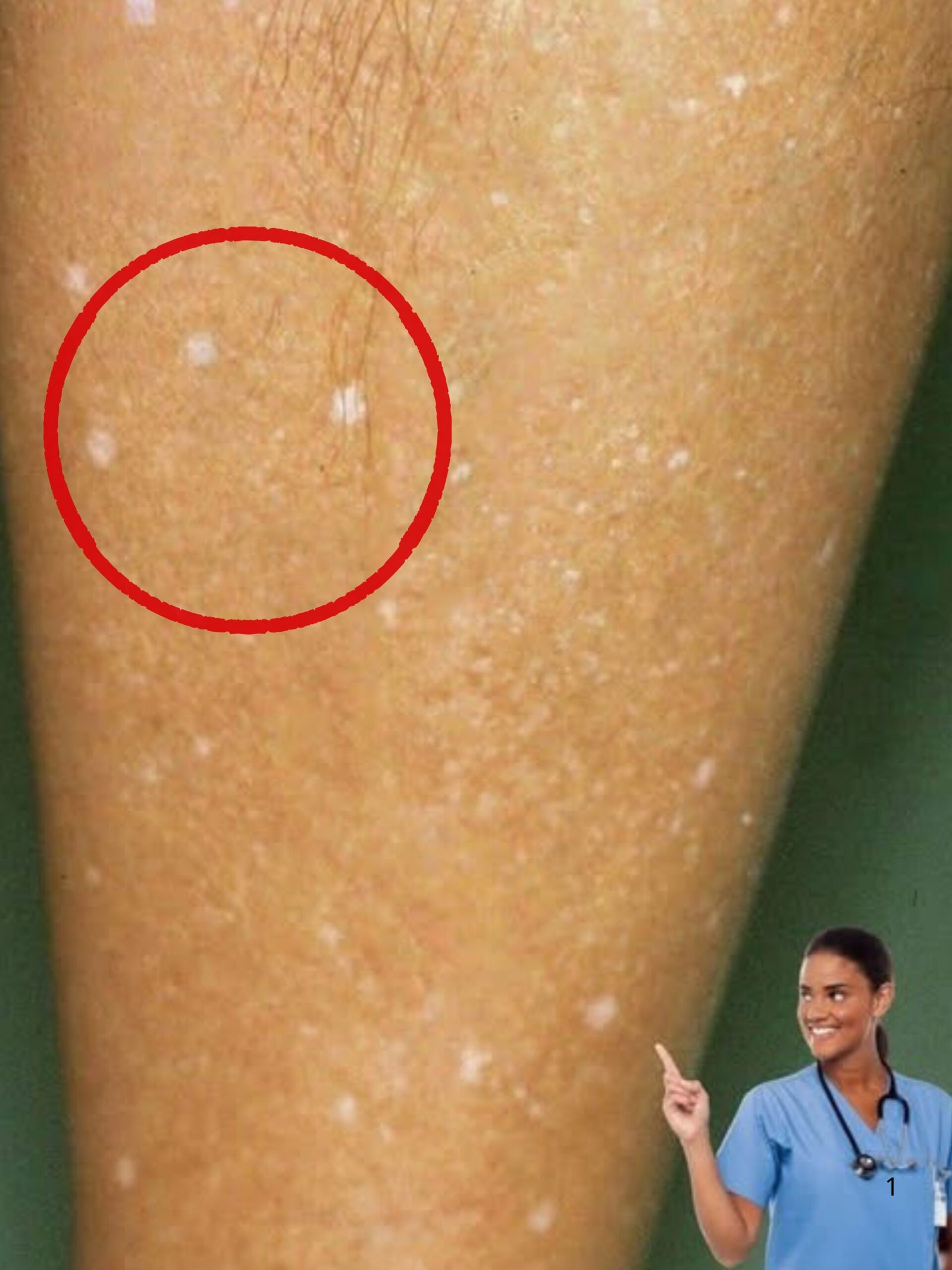 Révélé : 7 Remèdes Maison Insoupçonnés Pour Éradiquer Les Infections Fongiques de Votre Peau Avant Qu'il Ne Soit Trop Tard !