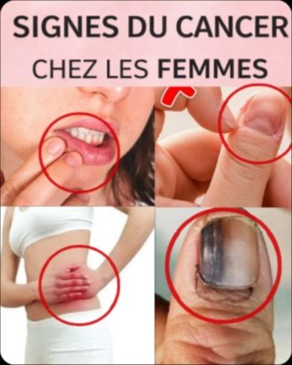 Révélation Choc : 14 Signes Subtils de Cancer que 9 Femmes sur 10 Manquent ! Votre Vie Pourrait en Dépendre