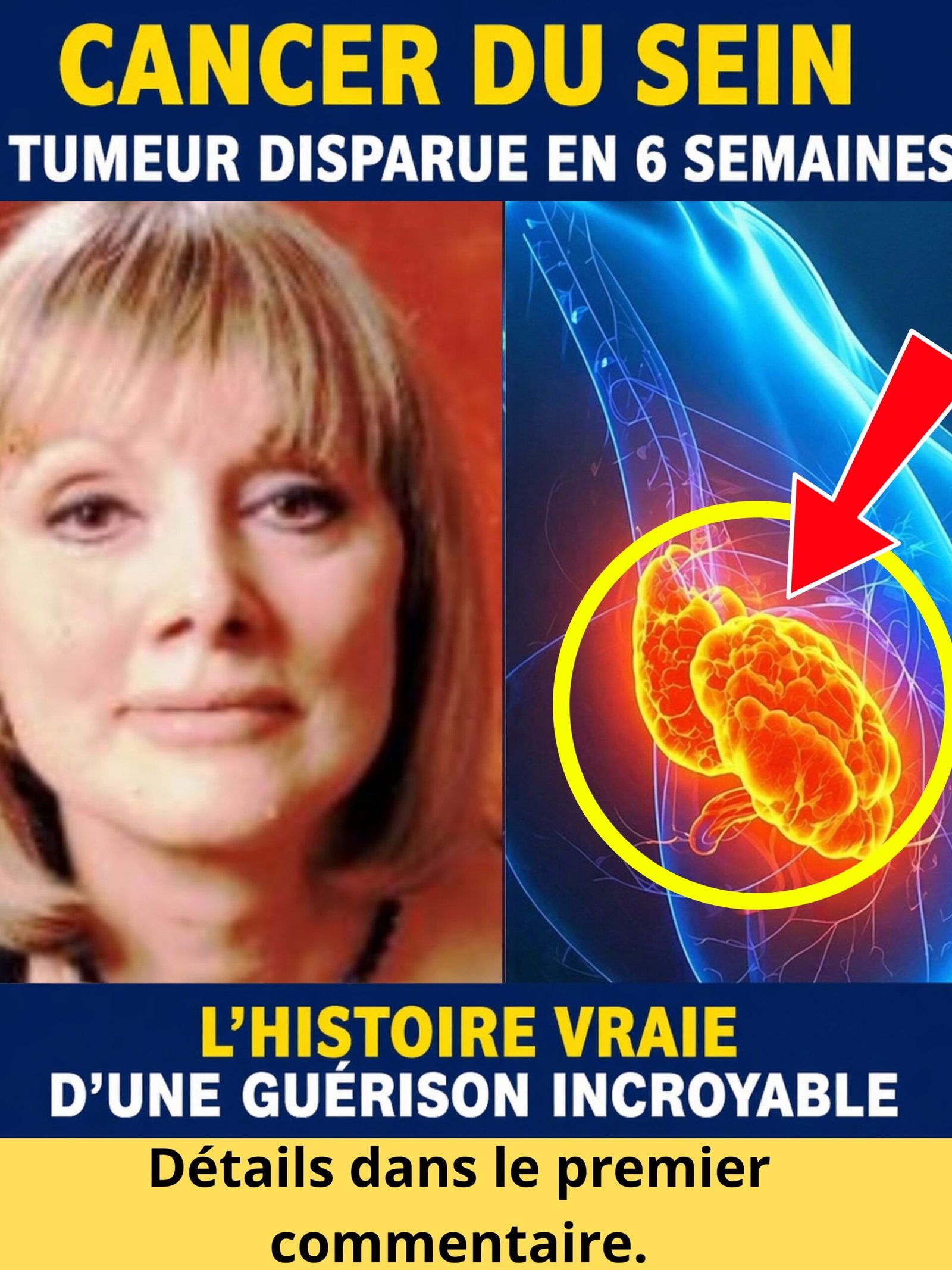 Le Secret Époustouflant: Comment Elle a Vaincu son Cancer du Sein en SEULEMENT 6 Semaines grâce à ce Régime Chinois Inattendu (Une Histoire Vraie Qui Va Tout Changer)
