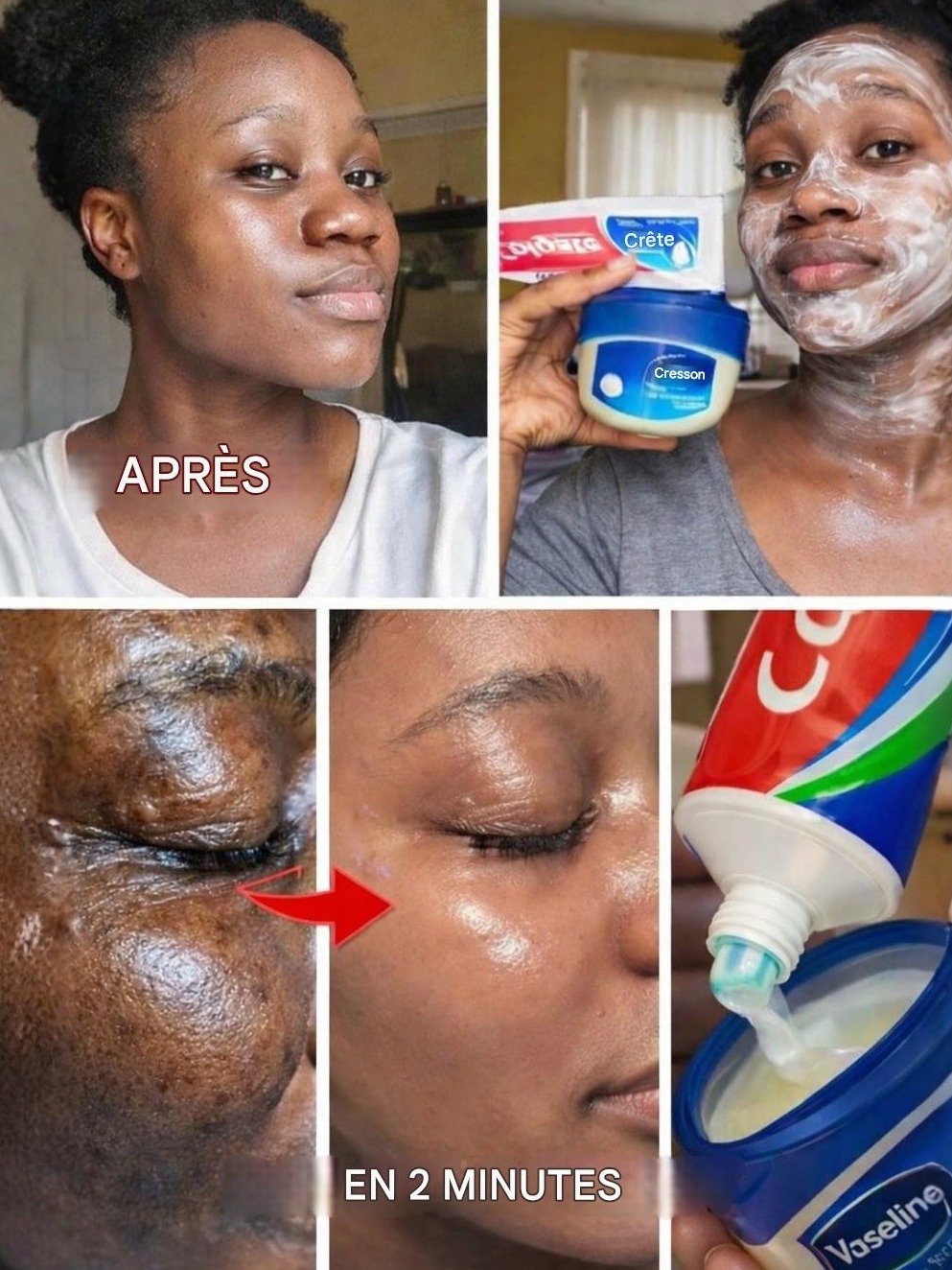 La Vérité Choc sur le Dentifrice et la Vaseline pour votre Peau : Miracle Viral ou Danger Caché ? (Ne cliquez pas avant de lire !)