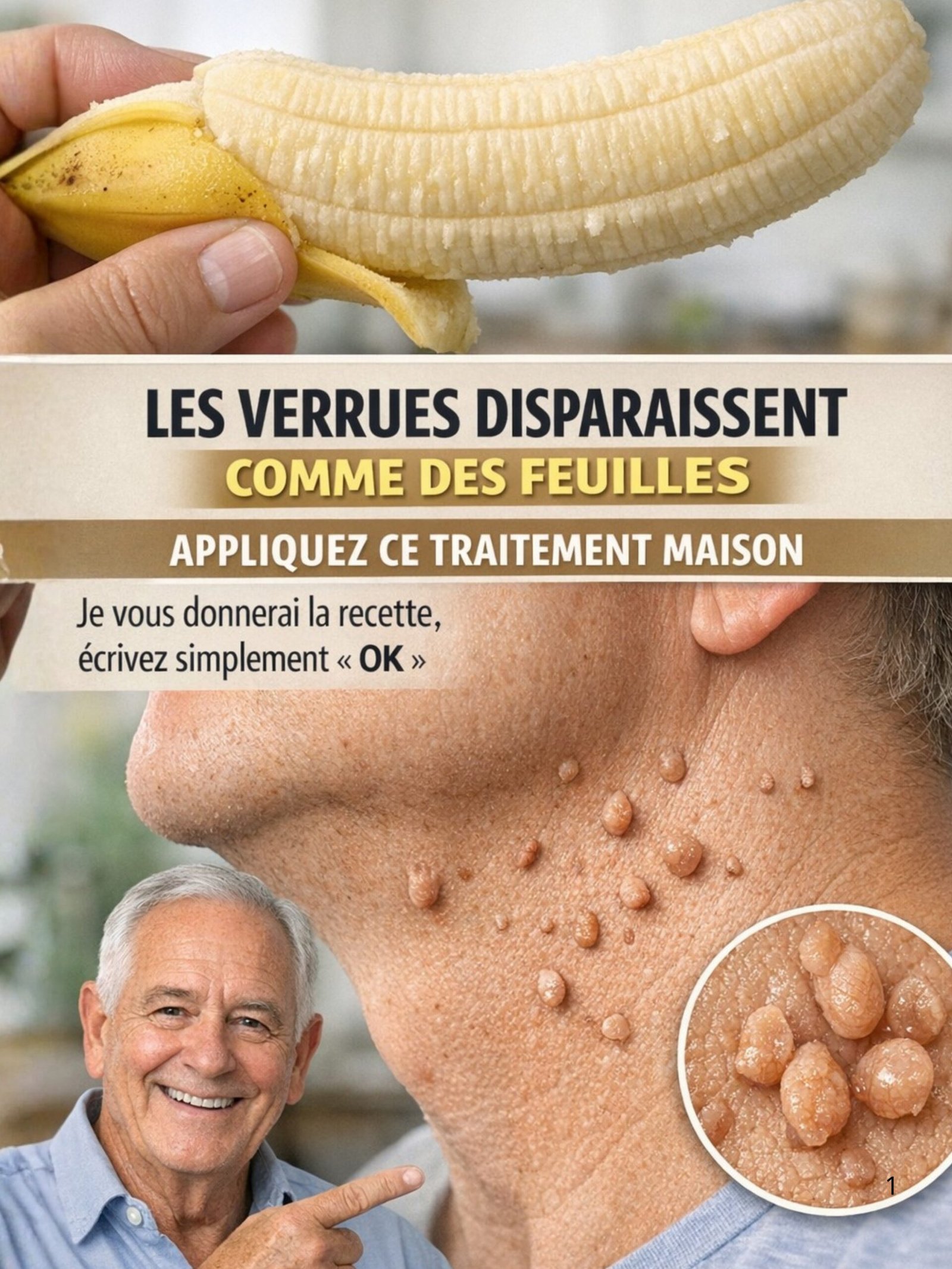 Verrues : Le Secret Oublié de la Peau de Banane Révélé (9 Effets Que Personne Ne Vous Dit) !