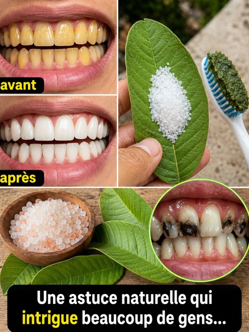 Le Secret Naturel Incroyable : 5 Feuilles de Goyave Suffisent pour un Sourire Éclatant en Moins de 7 Jours !