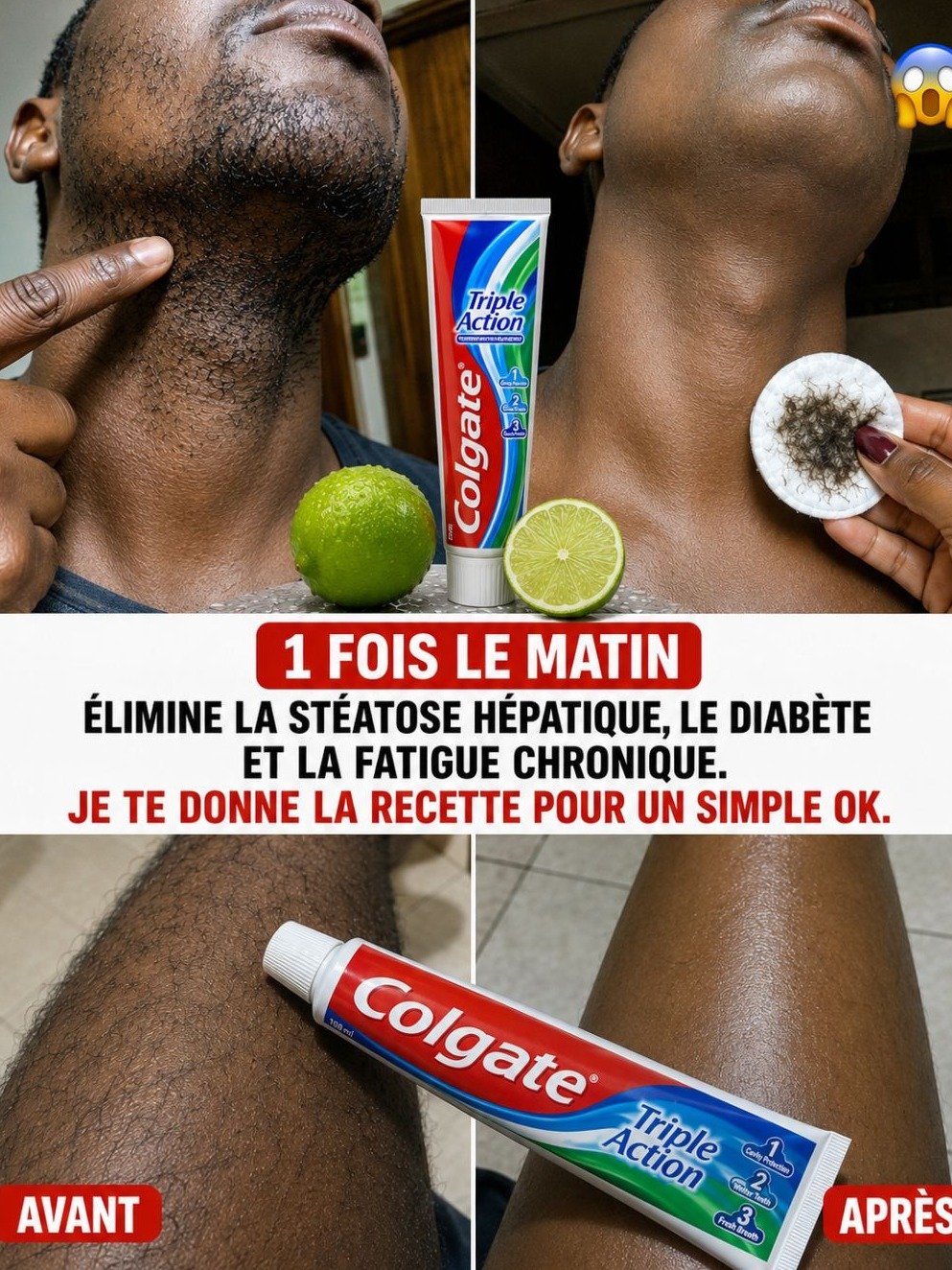 Attention, Mesdames de +50 ans ! Cette Pâte Dépilatoire Virale Cache un Secret Dévastateur pour Votre Peau (Vous DEVEZ lire ceci AVANT d'essayer !)