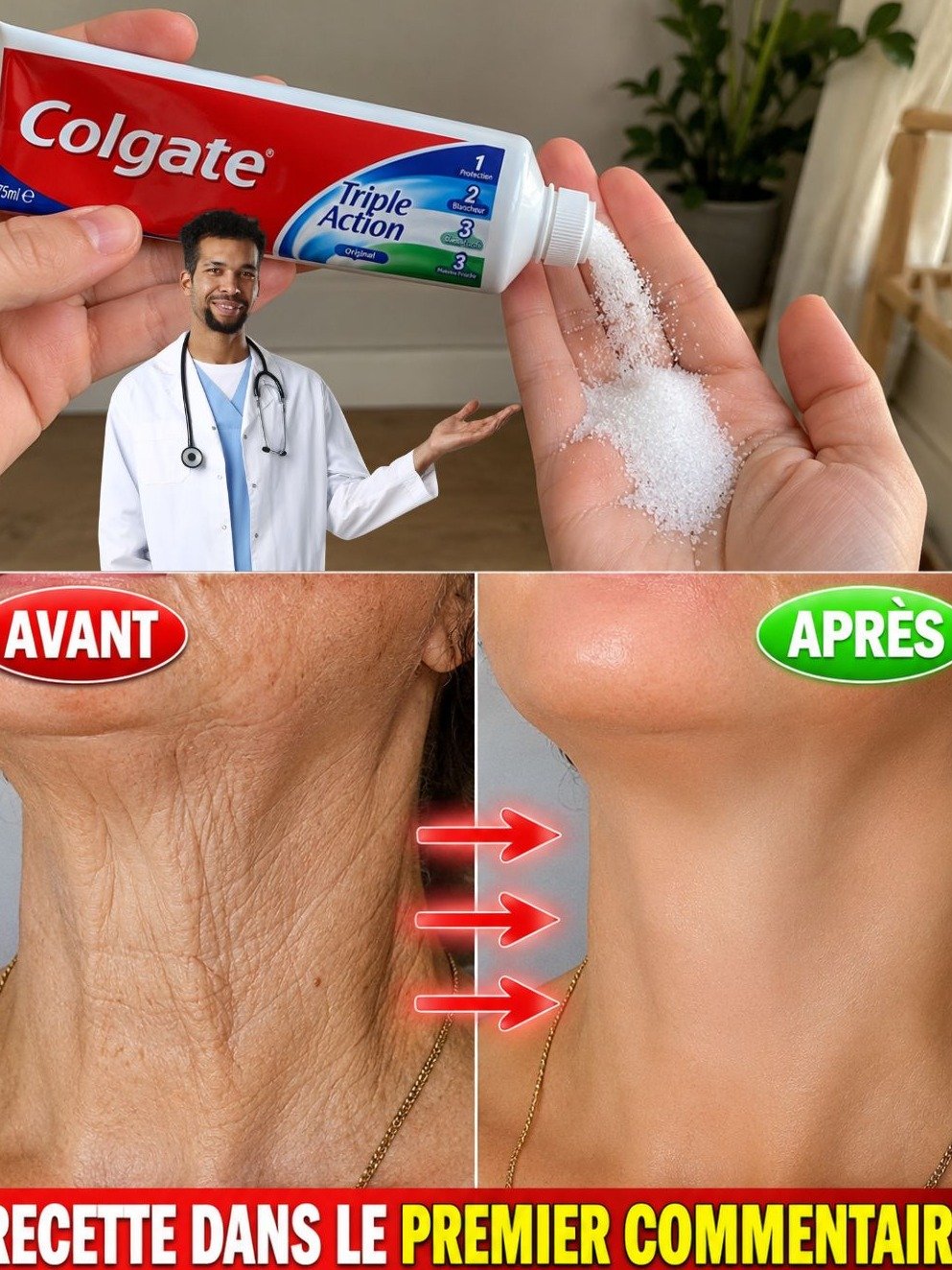 Arrêtez TOUT ! Voici Pourquoi Les Gens Pensent Que J'Ai Fait de la Chirurgie Pour Mes Mains et Mes Bras (La Recette Naturelle Ultime Contre Rides et Taches Brunes est là !)