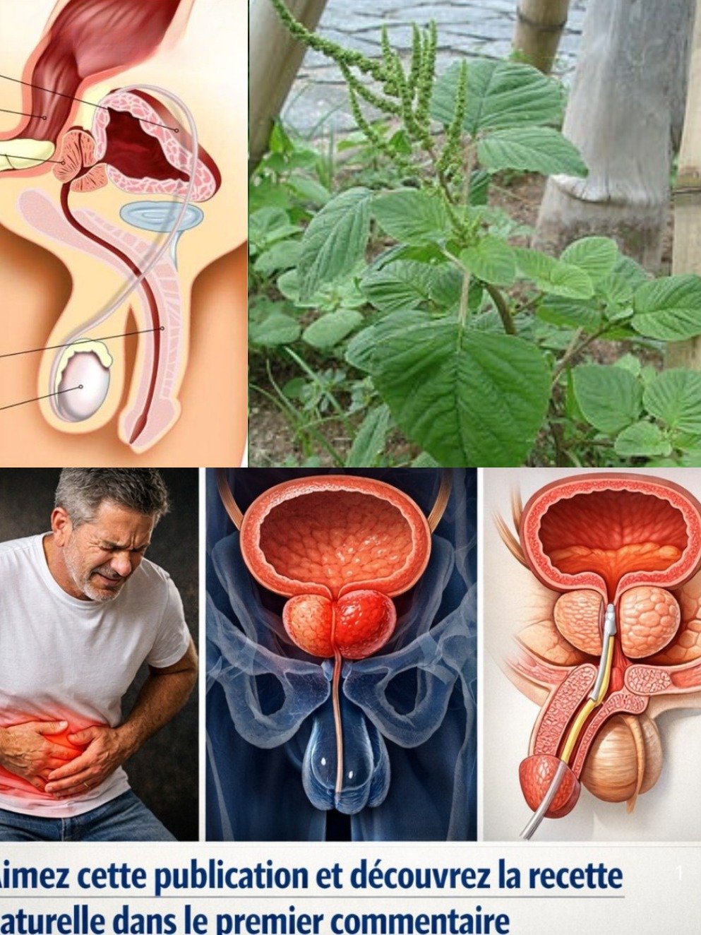 Prostate : Le SECRET ancestral que des milliers d'hommes ont DÉJÀ adopté pour des nuits paisibles et un confort retrouvé !