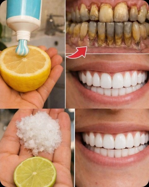 Le Secret Inattendu de Votre Cuisine : Blanchissez Vos Dents Naturellement en 4 Étapes Simples pour un Sourire Éclatant !